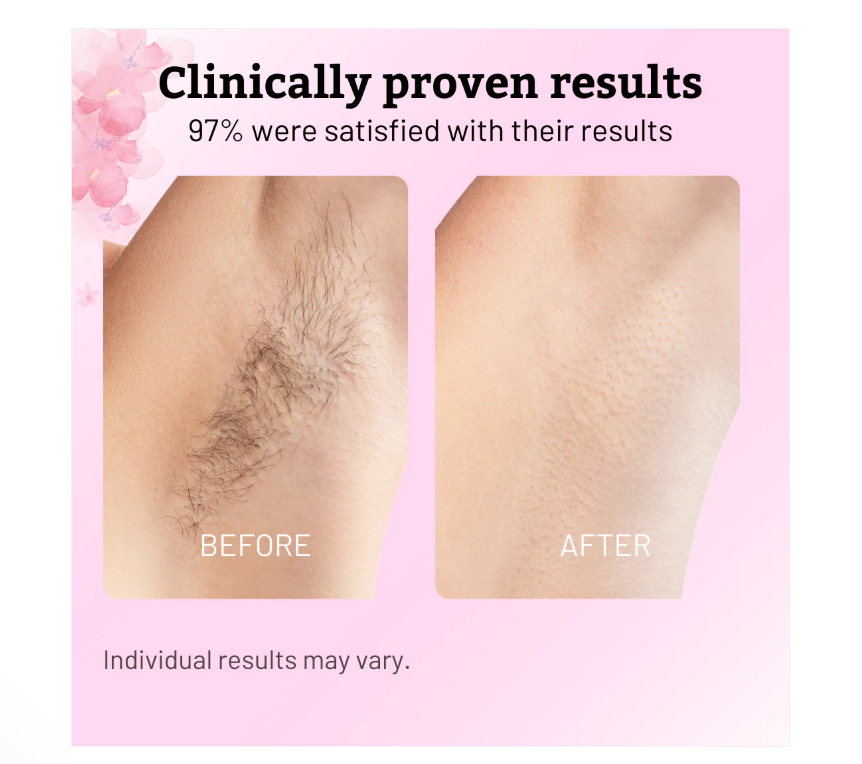 Lumina™ Hair Reduction Serum